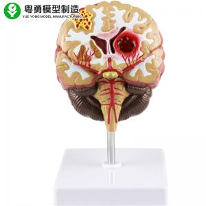 Pathologies Medical Brain Anatomy Model / Brain Human Anatomical Model