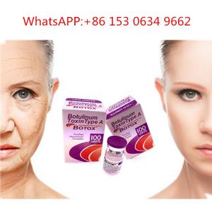 China 50u 100u 150u Type A Allergan Botox Injection Botulinum Toxin For Anti Wrinkle supplier