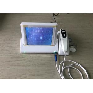 China Portable Dermatoscope Digital Skin Moisture And Oil Analyzer With 8 Inch Monitor supplier