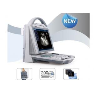 China Mobile Ultrasound Scanner Portable Ultrasound Scanner with Transvaginal Linear Convex Probe supplier