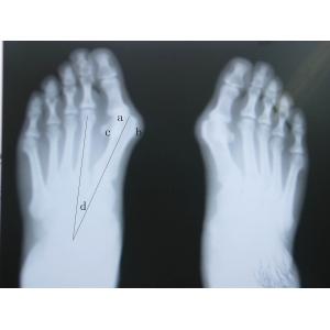 Professional Laser X Ray Diagnostic Imaging Anti Scratch For KODAK / FUJI / AGFA Printer