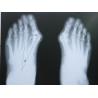 Anti éraflure de représentation diagnostique professionnelle du laser X Ray pour