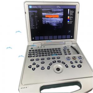 Chinese Full Digital Laptop 4D 5D Human Color Ultrasound  Scanner  portable  Laptop ultrasound machine  for pregnancy
