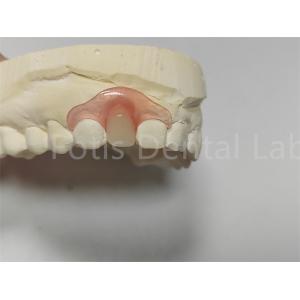 Flexible Pink / Transparent Valspar Dental Partials Easy Adjustment