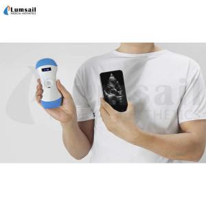 China Linear Convex Phased Array 3 In 1 Handheld Pocket Ultrasound Scanner With APP supplier