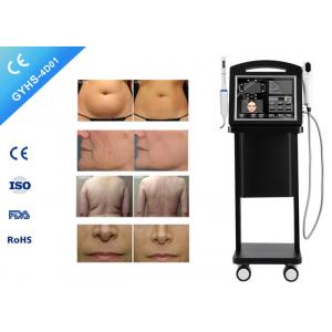 Face Lift Vigina Tightening Device Portable Face Lift Machine 20000 Shots