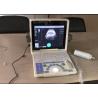 12 Inch LED Screen Portable Digital Ultrasound Scanner with All Kinds of Probes