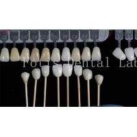 China Customization Natural Dental Veneers Fake Teeth Overlays High Strength on sale