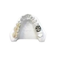 China Ultra Hard Digital Porcelain Dental Crown Health Safety High Density on sale