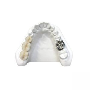Ultra Hard Digital Porcelain Dental Crown Health Safety High Density