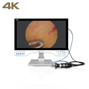 China TUYOU All-in-One FHD Endoscopy Camera System with 24" Surgical Monitor for Urology Procedures wholesale