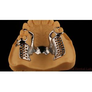 China Metal Alloys Partial Cobalt Chrome Dentures Ivoclar Scheftner Comfortable China Dental Lab wholesale