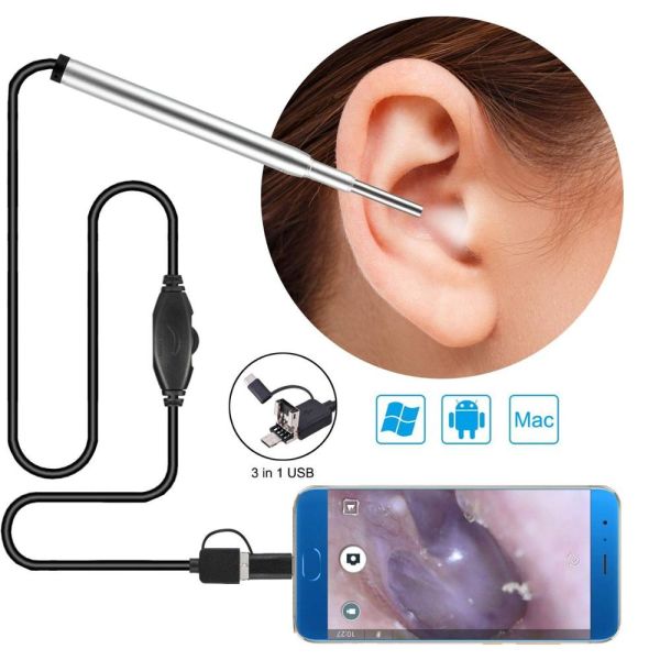 China IP68 3.9mm três em um Otoscope da câmera do endoscópio da orelha 67 graus supplier