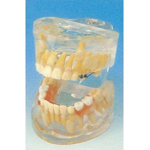 China Dental Schools Human Teeth Model / Transparent Milk Teeth Development Model wholesale