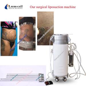 China Fat Removal Surgical Liposuction Machine Weight Loss Cavitation Vacuum Liposuction supplier
