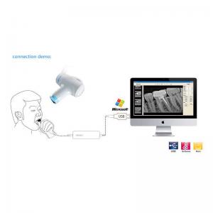 Handheld Portable Dental X Ray Machine Camera For Endodontic Treatment