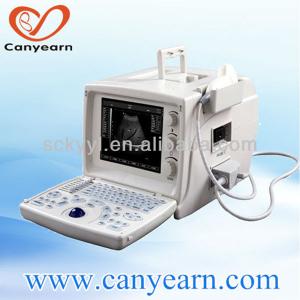 China portable ultrasound scanner better than Mindray in China medical device market supplier