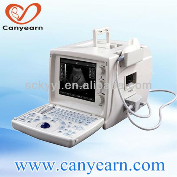 portable ultrasound scanner better than Mindray in China medical device market