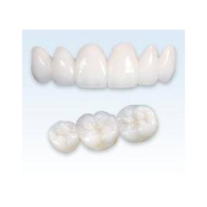 China 100% Biocompatible No Allergies Quick Solution Teeth Cosmetic Crowns And Bridges wholesale