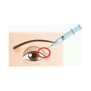 Non Cross Linked Medical Ophthalmic Sodium Hyaluronate Gel hyaluronic acid filler For Intr