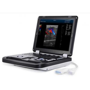 China Digital Portable Ultrasound Scanner Movable Color Doppler With 15 Inch LED Screen supplier