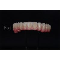 China Full Arch Implant Bridge All On 4 All On 6 For Complete Dental Restoration on sale