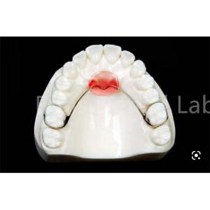 Adjustable Mouth Expanding Retainer For Safe Teeth Retention And Expansion
