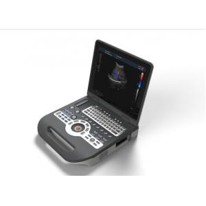 4d Ultrasound Machine Portable Ultrasound Scanner With 120G Capacity 4800 Frames​ Cine Loop