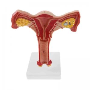 Medical Anatomy Female Reproductive System Model For Medical Science