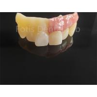 China Monolithic Zirconia Layered With Porcelain Computer Aided Design on sale