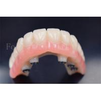 China Customized Dental Implants Crowns Replacement Wear Resistance on sale