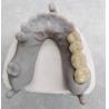 China White High Noble Precious Alloy Crown And Bridge Accurate And Custom wholesale