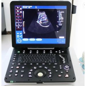 Medical Equipment High Quality Portable 3D 4D color doppler ultrasound MSLCU64 for Gynaecology