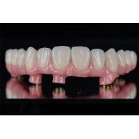 China Individual All On 4 All On 6 Dental Implants Restores Full Chewing Ability on sale