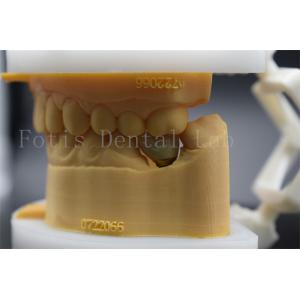 Long Lasting Polished Dental Lab Crowns Precision Fit Comfort For Patients