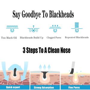 el acné de los productos para el cuidado de la piel del OEM 500ml encoge el removedor líquido de los poros de belleza de las espinillas gruesas del salón para la nariz