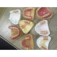 China Flexible TCS Valplast Removable Partial Denture Easy To Adjust on sale