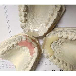 Resin Metal Free Invisible Denture For Allergic Patient