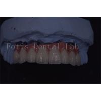 China Precision Crafted Dental Implant Crowns For Superior Longevity And Comfort on sale