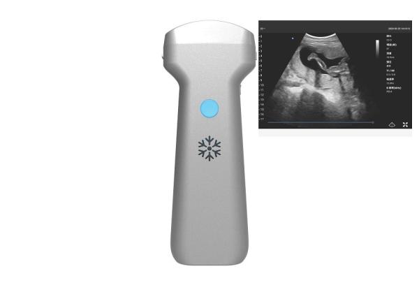 Electronic Convex Array Convex Wireless Ultrasound Probe 2MHz 3.6MHz 5MHz