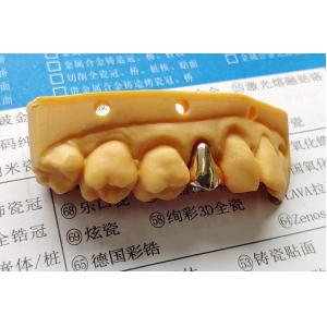 High Noble Gold Full Metal Dental Crown