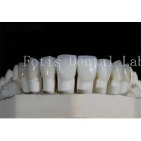 China Polished Dental Laminate Veneers High Translucency For Natural Looking Smiles on sale