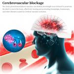 White Color Health Analyzer Machine Photobiomodulation Brain Injury Therapy