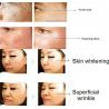 Home use RF skin tightening treatments