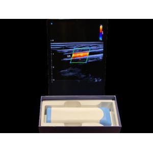Advanced Handheld Ultrasound Scanner 0.2kg With 3000mAh Battery For Medical