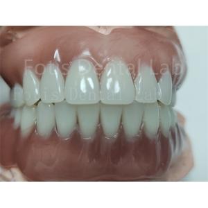 Comfortable Full Upper Acrylic Denture Complete Acrylic Denture With Ivoclar Teeth