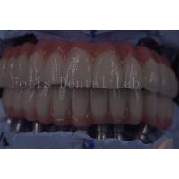 China Advanced Clinic Dental Implant Crowns For Superior Functionality on sale
