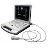 Laptop Ultrasound machine Color Doppler scanner ultrasound system C60