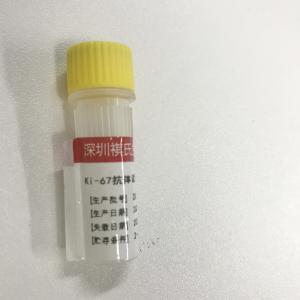 China KISSH Primary Antibody Products Ki-67 Immunoassay Antibody Test IHC 1.5mL 3.0mL supplier