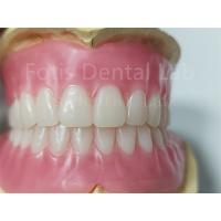 China Durable Natural Color Full Acrylic Denture Odorless Customization on sale